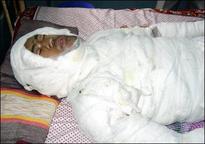 Dying for a cause...